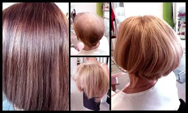 Vorher-nachher Vergleich von Haarausfall und Haarverdichtung bei Frauen im Friseursalon.